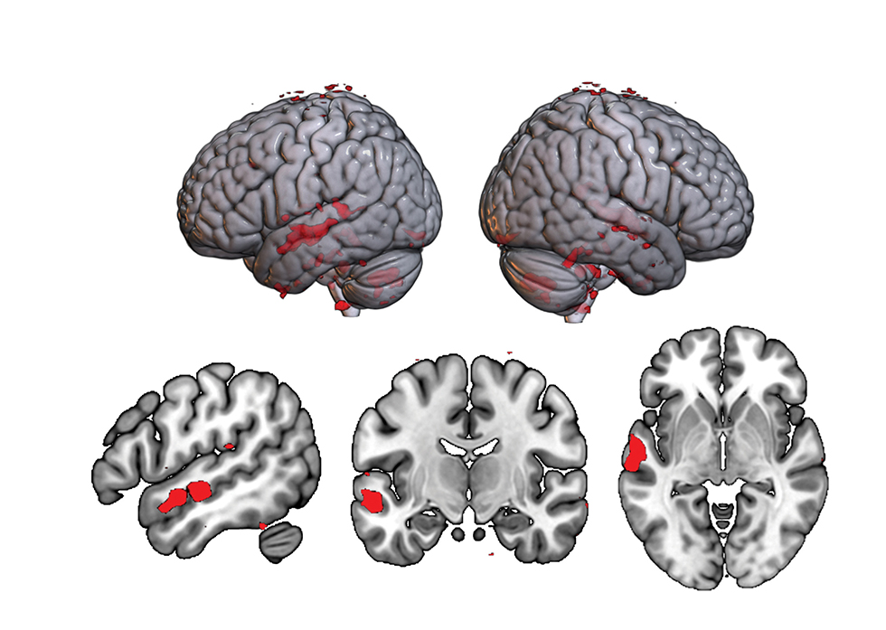 autism research studies